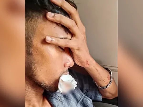 চলন্ত ট্রেনে পাথর নিক্ষেপ, ভাঙলো যাত্রীর ৪ দাঁত