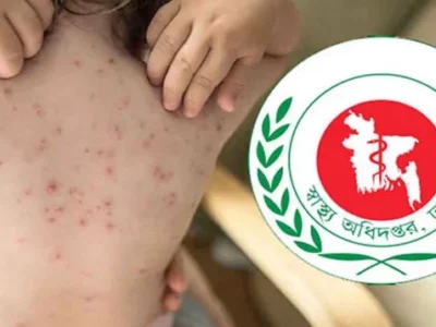 হামে একদিনে ৯ শিশুর মৃত্যু!