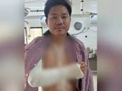 খাগড়াছড়িতে তেল না পেয়ে ট্যাগ অফিসারের হাত ভেঙে দেওয়া হলো!