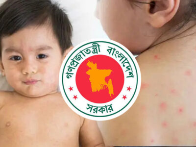 হামে আরও ৪ শিশুর মৃত্যু
