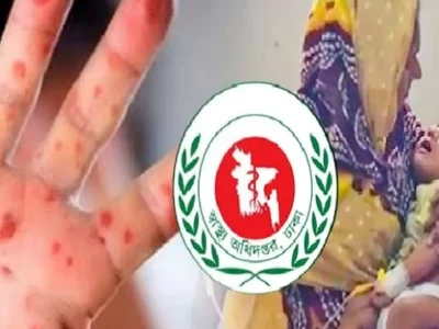 হামের উপসর্গে আরও ৩ শিশুর মৃত্যু