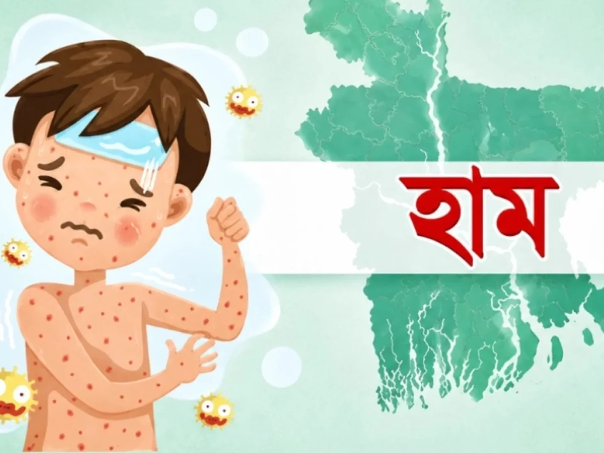 হাম নিয়ে একদিনে আরো ২ মৃত্যু!